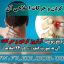 آرتروز گردن و حرکات اصلاحی آرتروز گردن